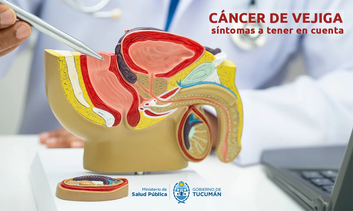 portada-cancer-vejiga